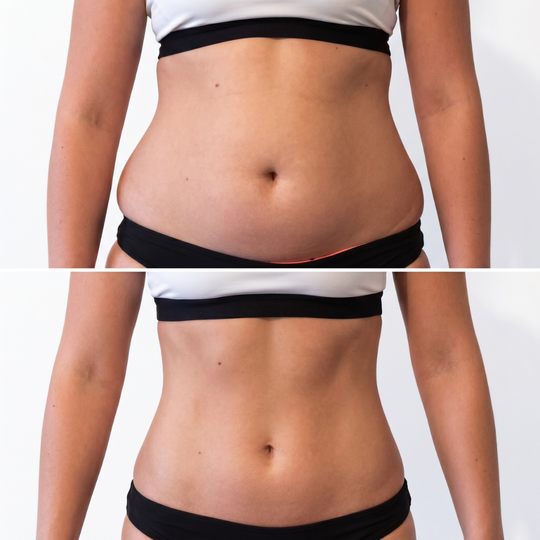 Postpartum belly band giving light belly compression